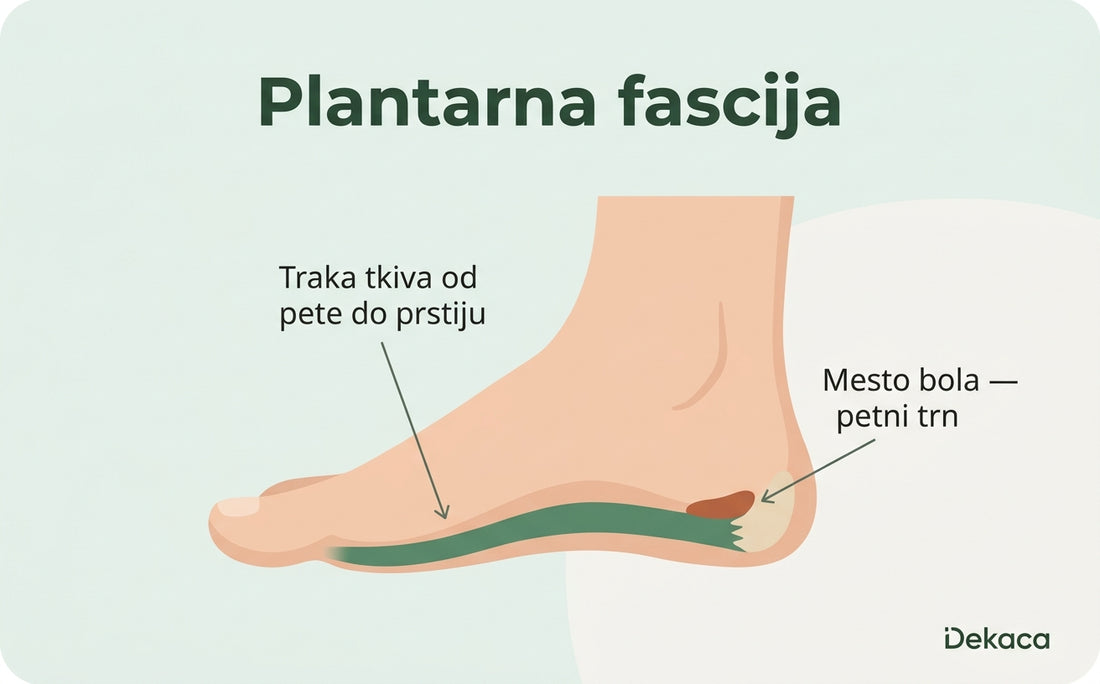 Ilustracija stopala sa označenom plantarnom fascijom i mestom bola u peti