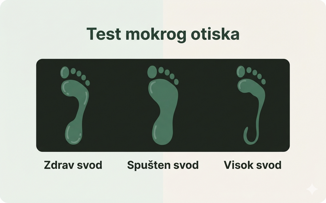 Test mokrog otiska — otisci za zdrav svod, spušten svod i visok svod